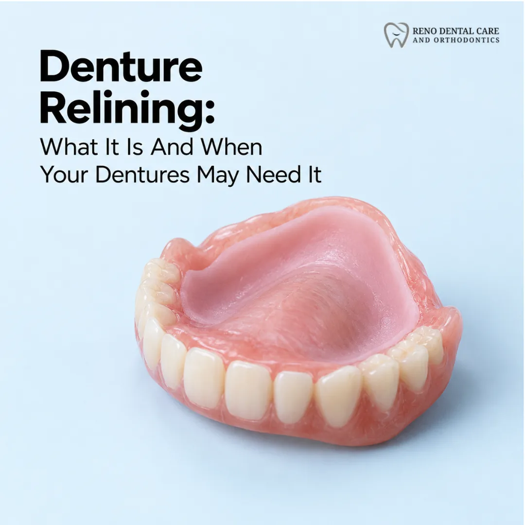 Denture Relining: What It Is And When Your Dentures May Need It