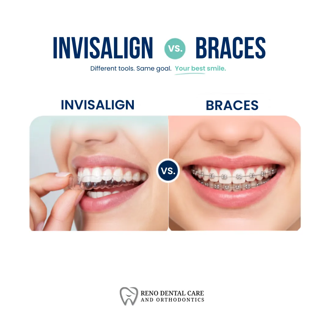 Invisalign vs. Braces: Pros, Cons, Costs, and Best Choice
